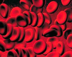 Collection of ketone body in blood in diabetes
